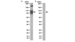 Adenylate Cyclase 5 Mouse anti-Mouse, Rat, Porcine, Clone: 19D5.C1, MilliporeSigma